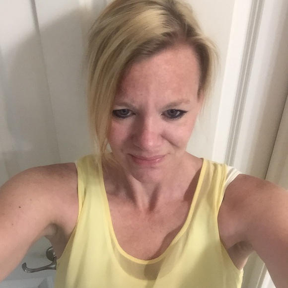 YELLOW TANK WITH LACE DETAIL - Picture 3 of 6